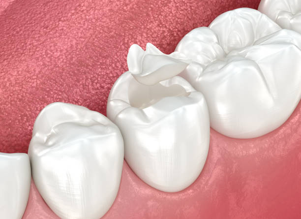 Best Dental Studio in Deshler, OH